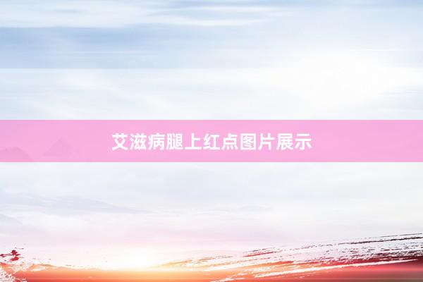 艾滋病腿上红点图片展示